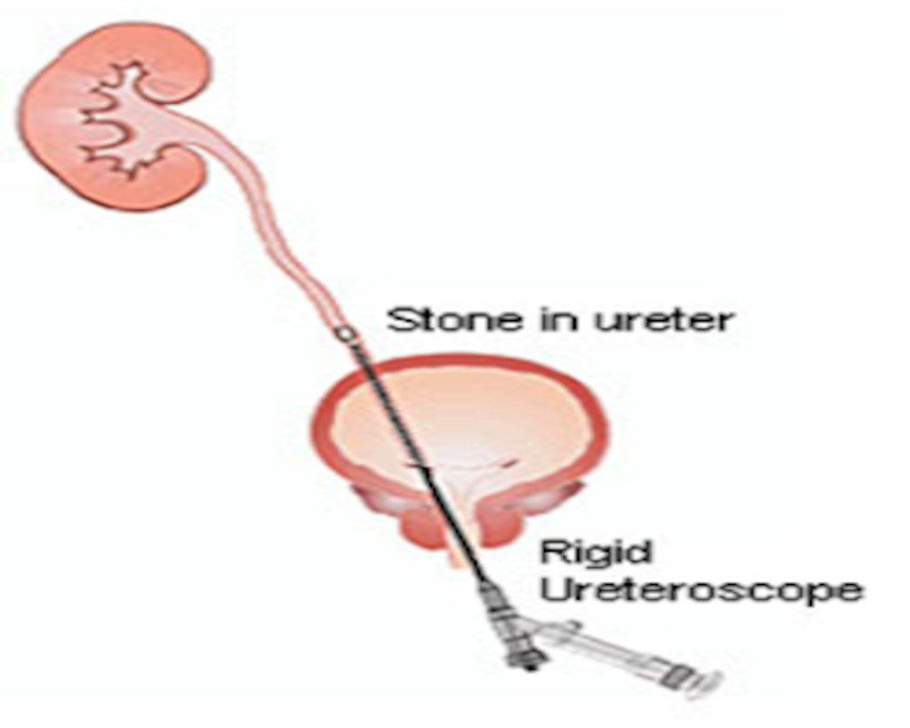 ursl-surgery